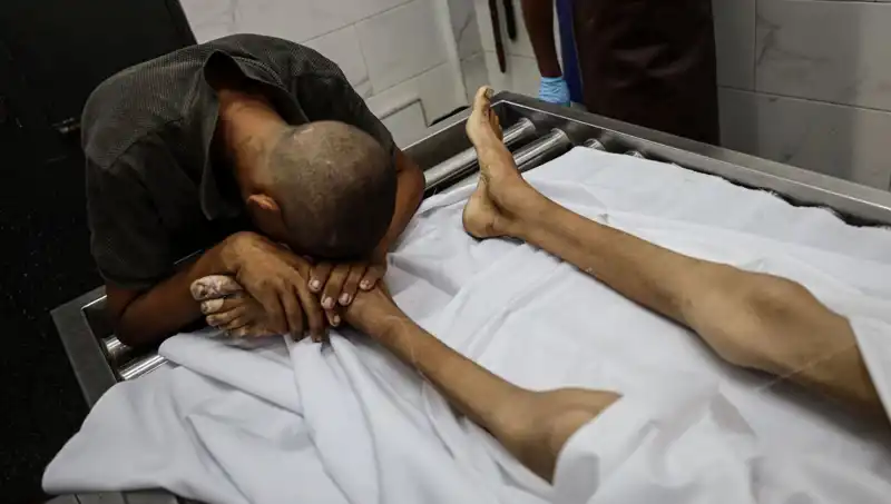 Gazze'de Açlık Pençesinde Bir Çocuk Daha: İnsanlık Dramı Yaşanıyor